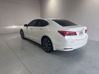 2015 Acura TLX V6 Tech